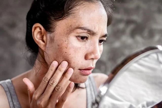 Cutting Edge RF Microneedling